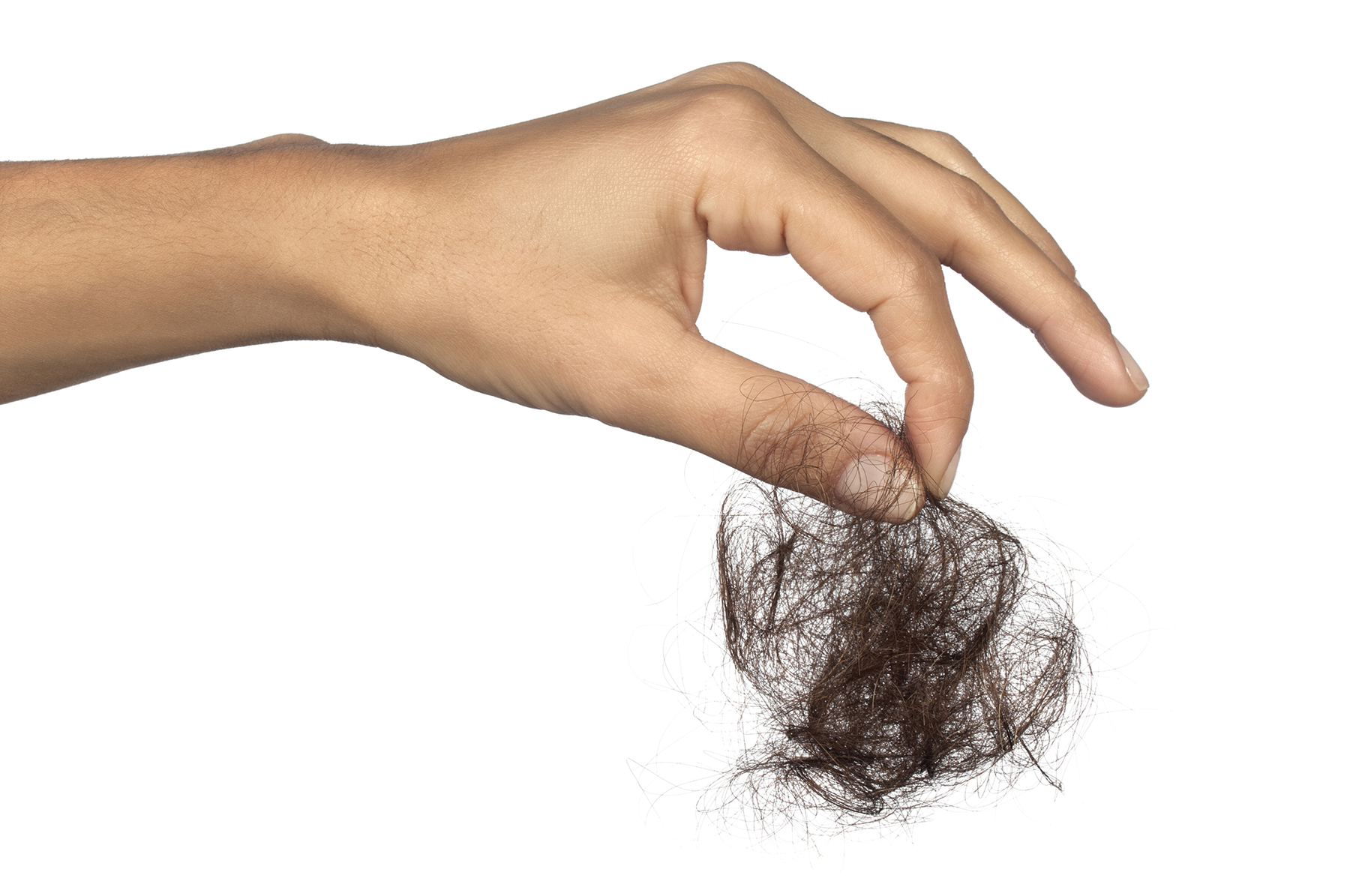 Nutritional Causes of Hair Loss